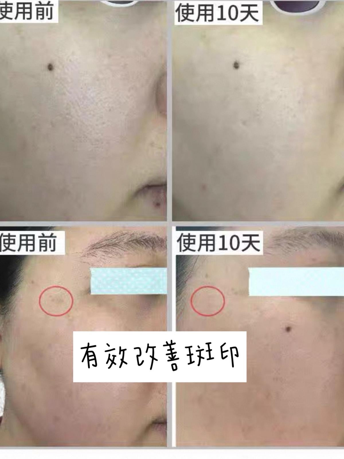 （日本🇯🇵）CRE CHEZ 強效收毛孔急救面膜 (1盒30支) (預訂四星期到貨)